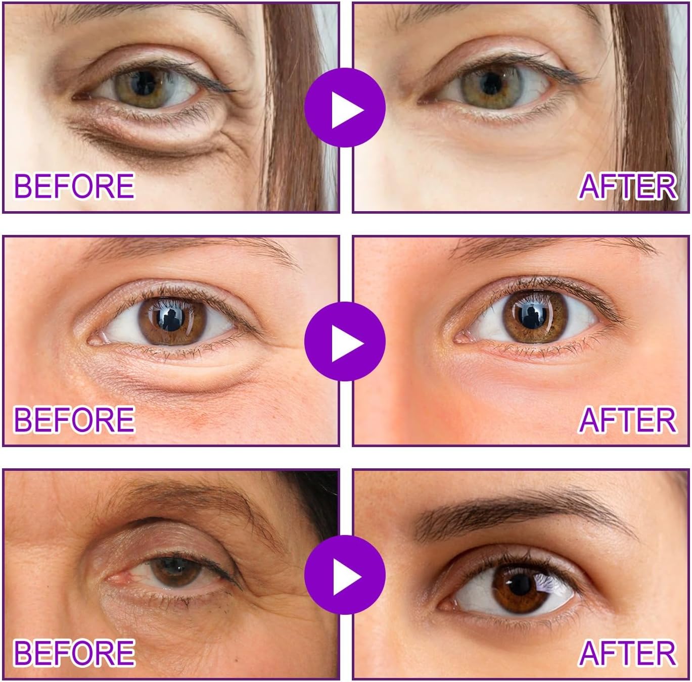 Micro Glow Patches by NOVALIFT