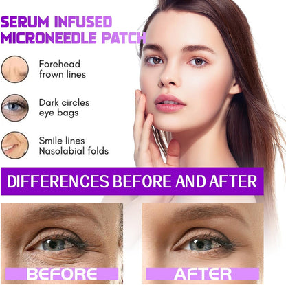 Micro Glow Patches by NOVALIFT